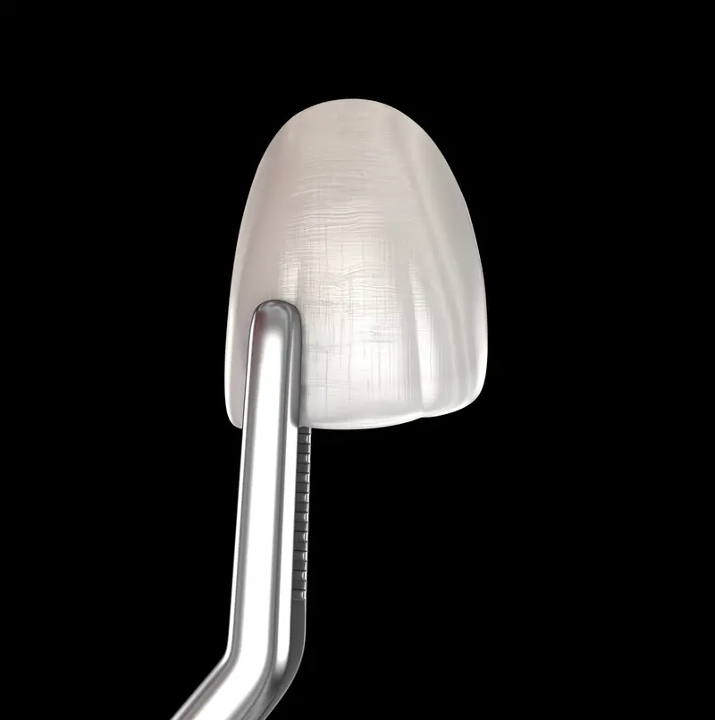 Carilla dental sujeta con un instrumento sobre fondo negro