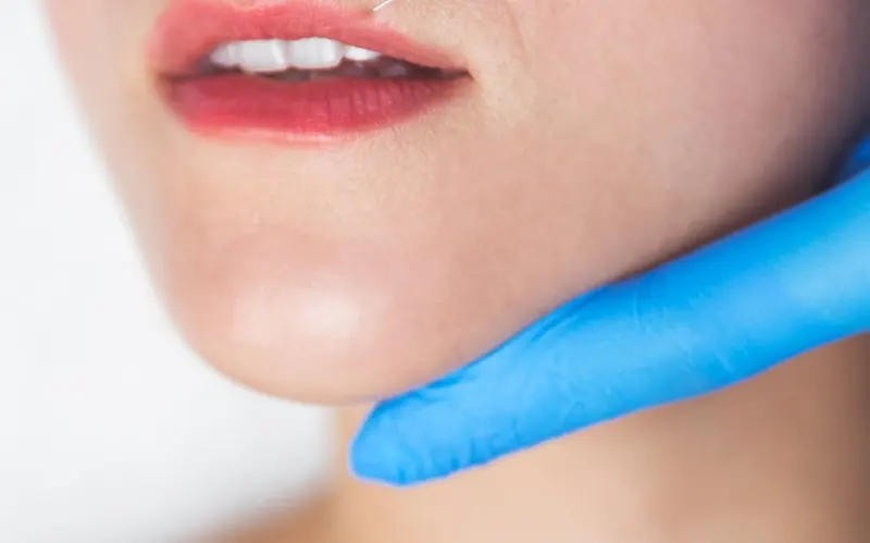 Inyección de ácido hialurónico en el labio con guantes azules
