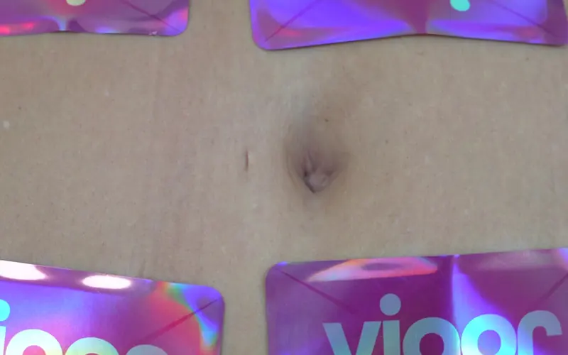 Parches Wonder Vigor colocados en el abdomen durante una sesión