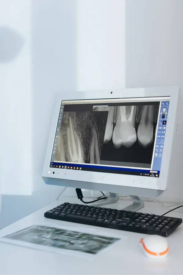Sillón dental con la radiografía en pantalla