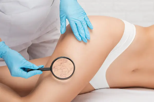 Revisión de las piernas con lupa