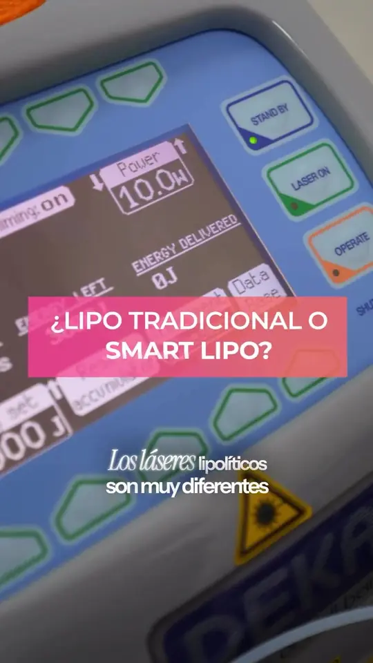 ¿Lipo tradicional o Smartlipo?