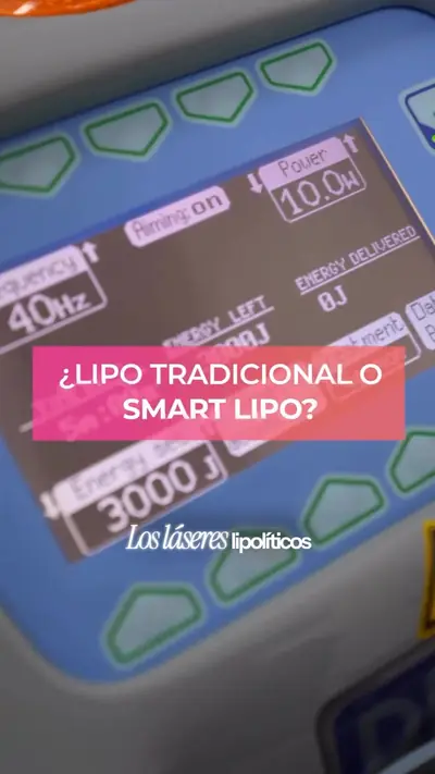 Lipoláser: así trabajamos