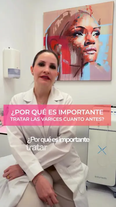 Varices y arañas vasculares: cómo las tratamos