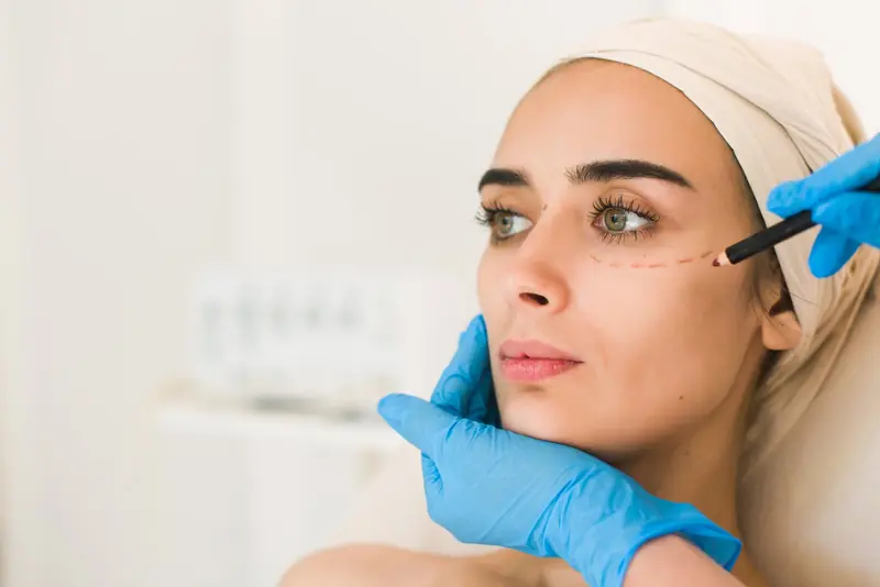 Médico marcando el rostro de una paciente con los ojos cerrados antes de un tratamiento